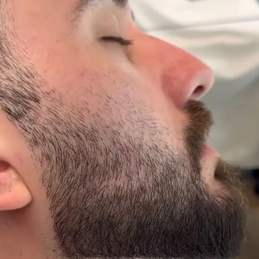 Close-up profile of a groomed beard with a clean cheek line